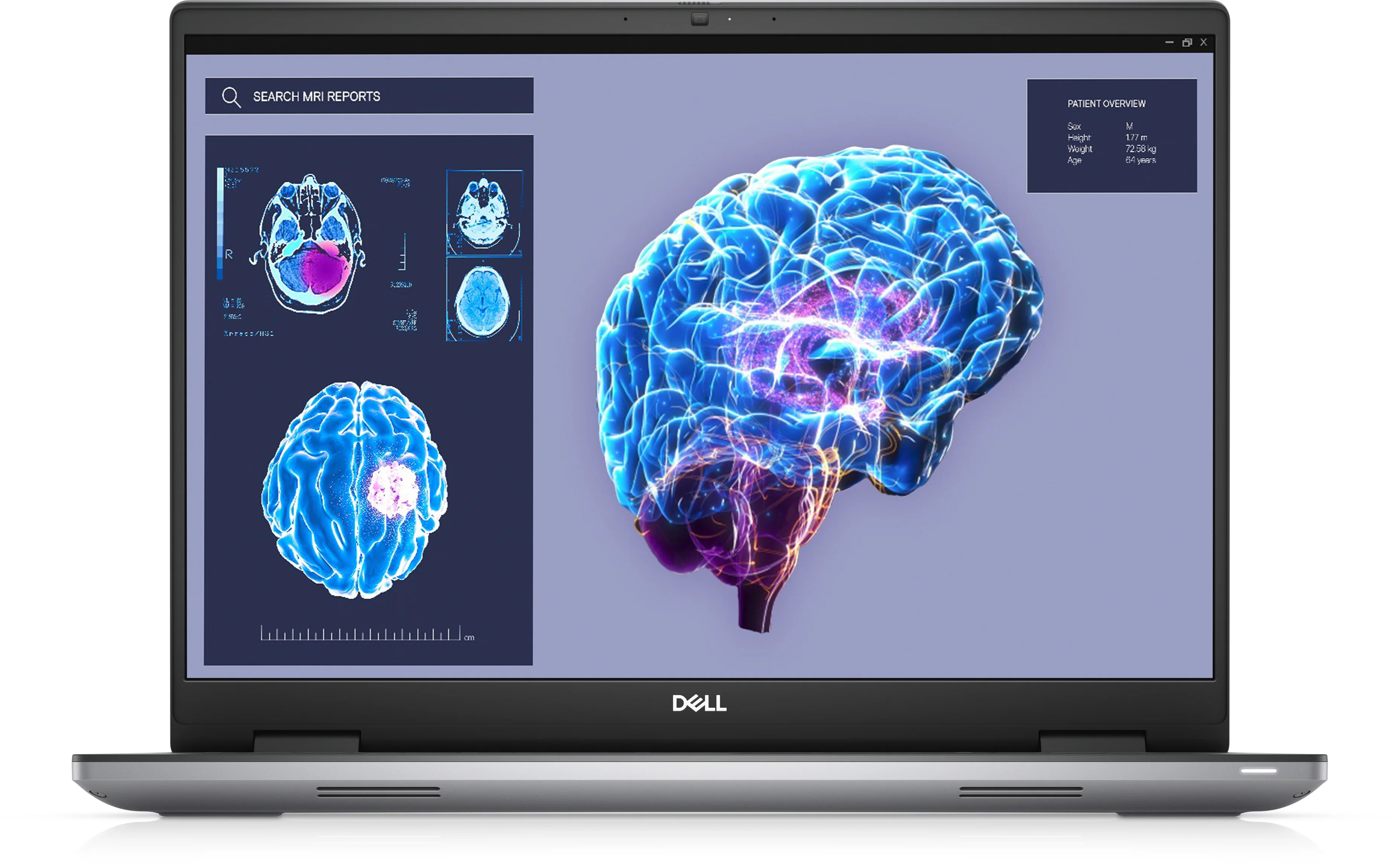 DELL Precision 7680 Intel® Core™ i7 i7-13850HX Mobiler Arbeitsplatz 40,6 cm (16") Full HD+ 32 GB DDR5-SDRAM 1 TB SSD NVIDIA RTX 2000 Ada Wi-Fi 6E (802.11ax) Windows 11 Pro Grau Deutsch